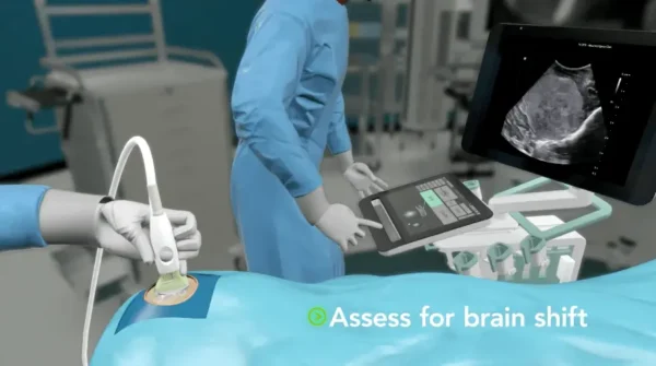 bkActiv - Neurosurgery and Spine